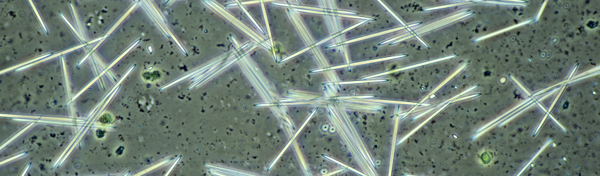 Calcium Oxalate Crystals In Plants Cell Mediated Crystallization Of What Does Health Insurance Really Cover In Detail?