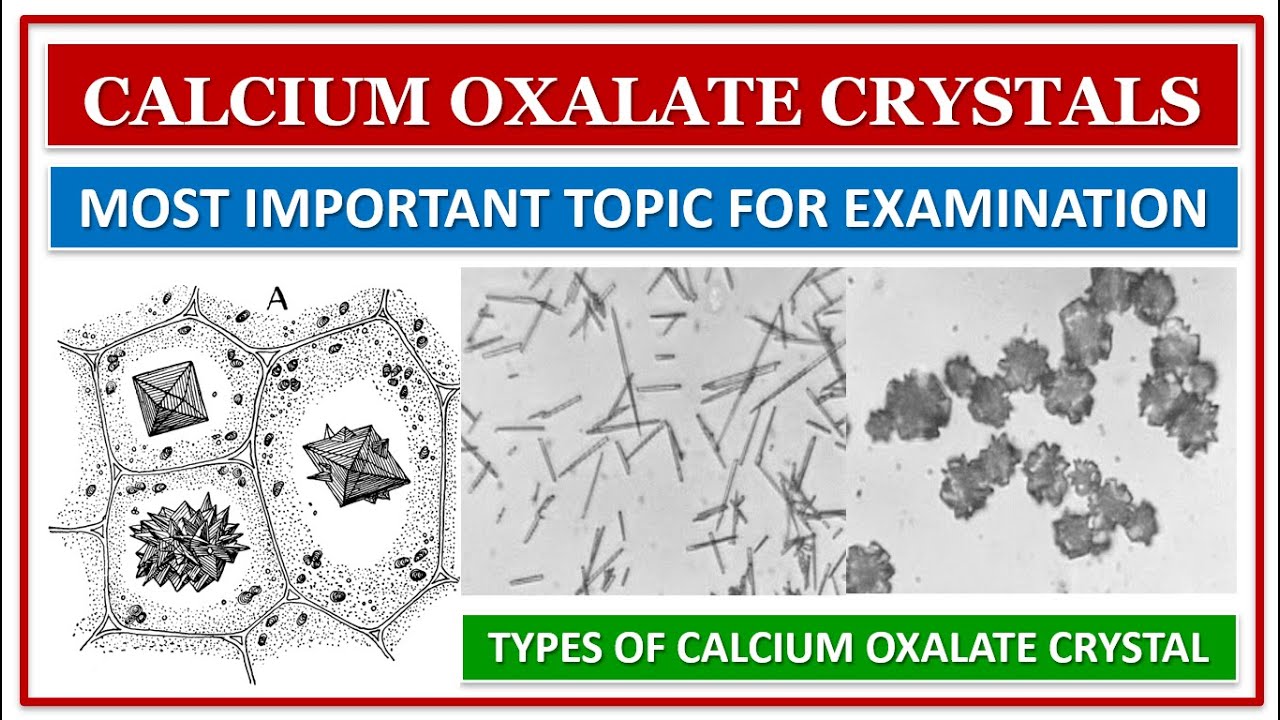 (PDF) Calcium Oxalate Crystals, the Plant ‘Gemstones’: Insights into ... What Does Health Insurance Really Cover In Detail?